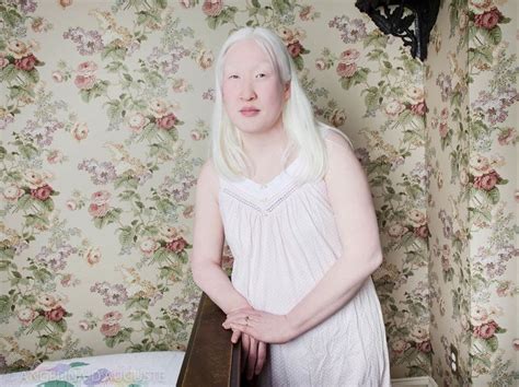 58 Albino People Wholl Mesmerize You With Their Otherworldly Beauty