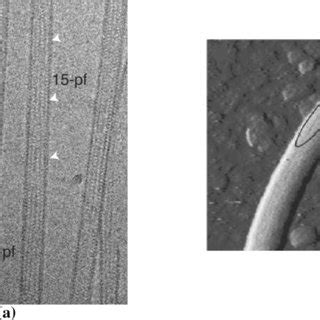 A curved microtubule bundles and neuron’s configuration lied on the ...