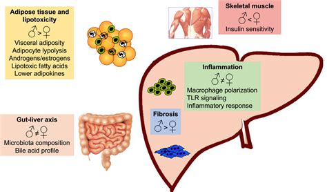 Clinical Impact Of Sexual Dimorphism In Non‐alcoholic Fatty Liver Disease Nafld And Non