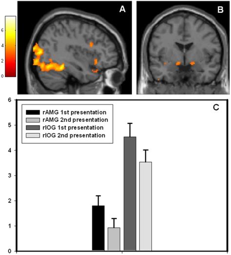 Bold Fmri Responses In The Amygdala And Visual Cortex Obtained For The