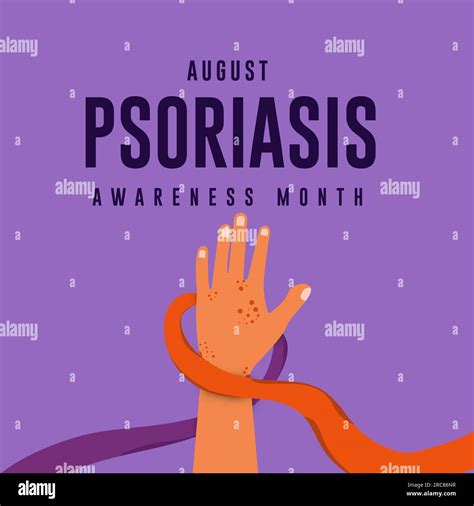 Psoriasis Psoriatic Skin Disease Banque Dimages Vectorielles Alamy