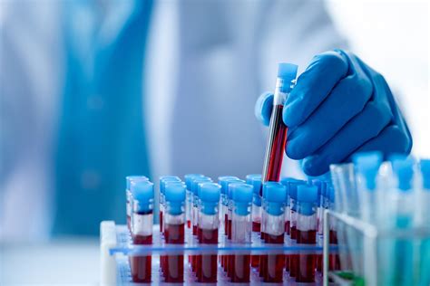 revolutionising clinical trials  active tracking