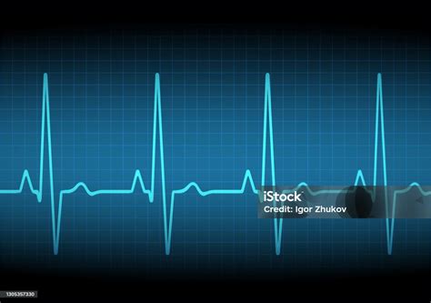 Grafik Denyut Jantung Detak Jantung Gelombang Ikon Ekg Warna Pirus