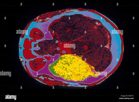 Corte Transversal Del Cerebro Fotograf As E Im Genes De Alta Resoluci N