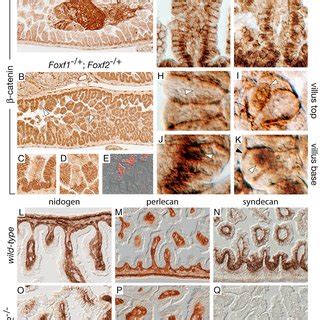 Accumulation Of Catenin In Foxf Mutant Intestinal Epithelium Catenin