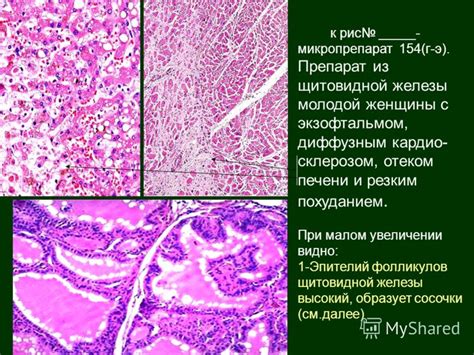 Микропрепараты И Их Описание По Патанатомии - azfont