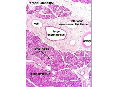 Parotid gland infection treatment antibiotic