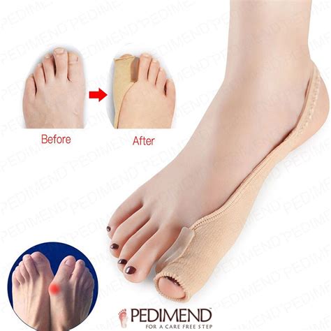 Pedimend Hallux Valgus Correction Tape Bunion Orthopedic Thumb Braces