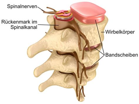 Spinalkanalstenose Informationen Empfohlene Spezialisten