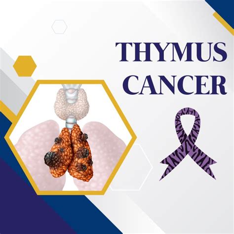 Thymus Cancer - UHAPO