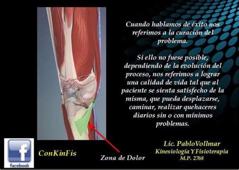 Tendinitis Pata De Ganso Ppt