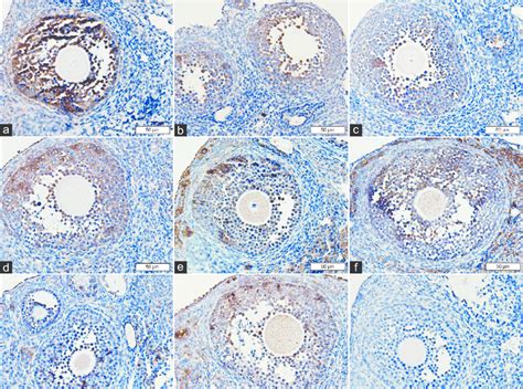 Immunohistochemical Staining For Bax In The A Control B Hydrogen