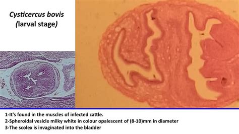 33 Practical Parasitology Cysticercus Bovis Larval Stage Youtube