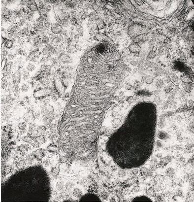 Mitochondrion electron micrograph — Science Learning Hub