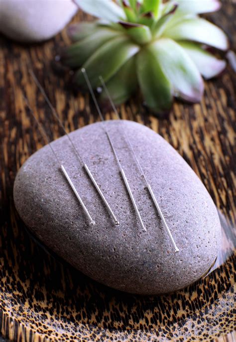Dry Needling - Wynyard Chiro - Your Sydney CBD Chiropractor
