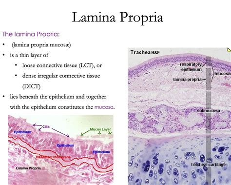 Lamina Propria - Histology | Loose connective tissue, Nursing school ...