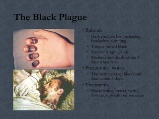 Medieval plagues and medicine | PPT