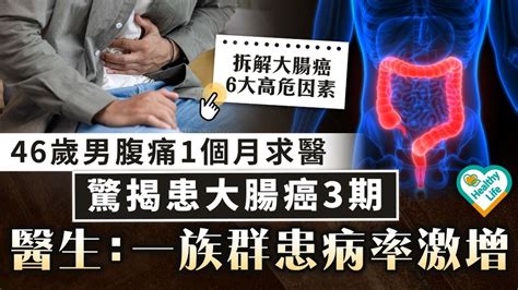 癌症殺手｜46歲男腹痛1個月求醫驚揭患大腸癌3期 醫生：一族群患病率激增 晴報 健康 腫瘤及癌症 D240405