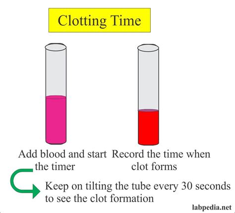 Clotting Time (C T) – Labpedia.net