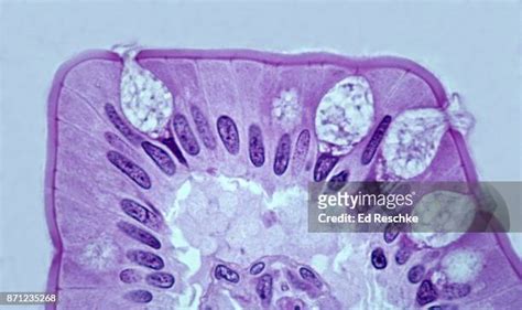 107 Simple Columnar Epithelium Stock Photos High Res Pictures And