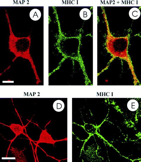 MHC Class I Molecules On The Neuronal Cell Surface Confocal Laser