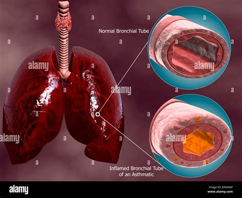 53+ Diagram Of Bronchial Tubes - KaylumColby