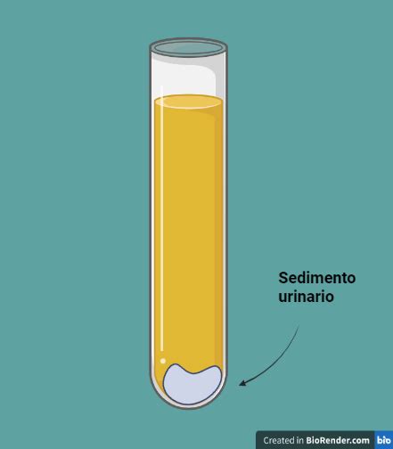 La orina y su análisis en el laboratorio