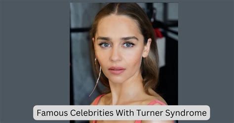 Celebrities With Turner Syndrome Top 20