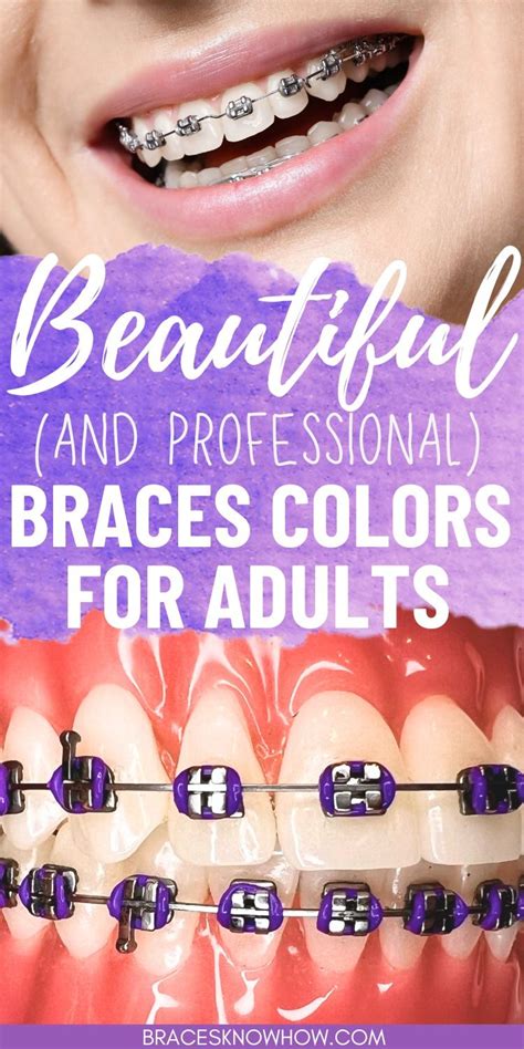 Best Braces Colors For Adults Which One Is You Artofit