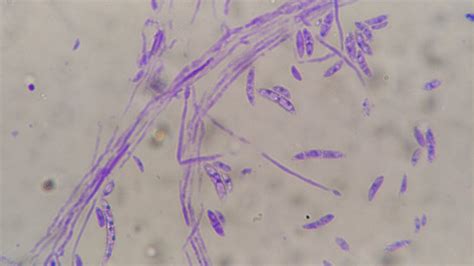 フザリウム菌から農作物を守ろう病気の見分け方や防除の方法 施設園芸