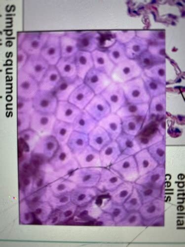 Epithelial And Connective Tissue Practical Flashcards Quizlet