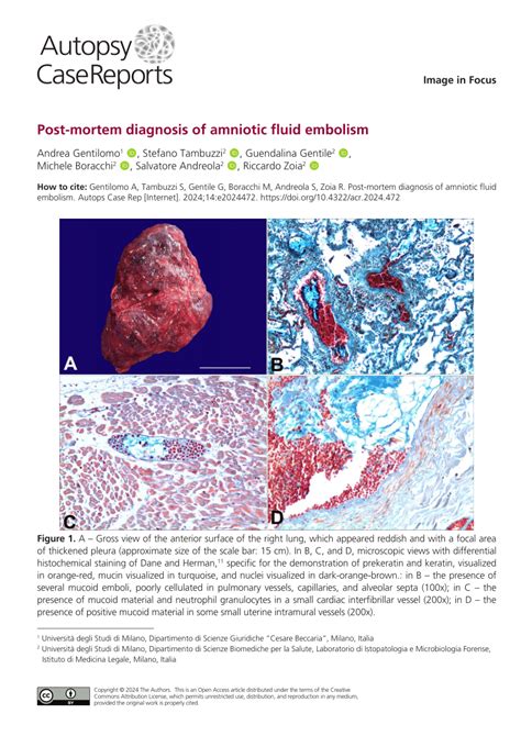 Pdf Post Mortem Diagnosis Of Amniotic Fluid Embolism