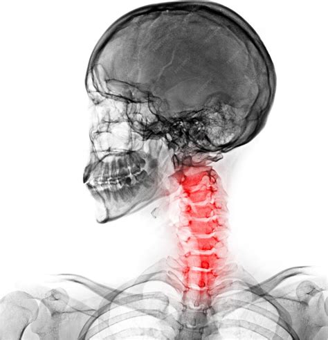 Premium Photo | A skeleton with the spine highlighted in red