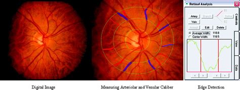 Retinal Vascular Imaging Circulation Cardiovascular Imaging