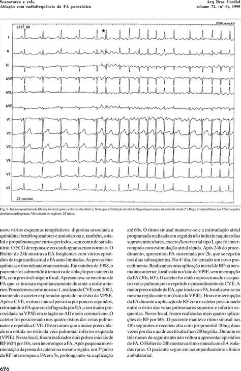 Ablação Com Radiofreqüência Da Fibrilação Atrial Paroxística Pdf Free