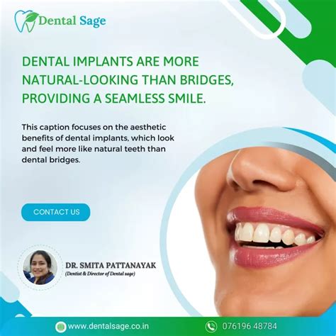 PPT Benefits Of Dental Implants Over Bridges Dental Clinic