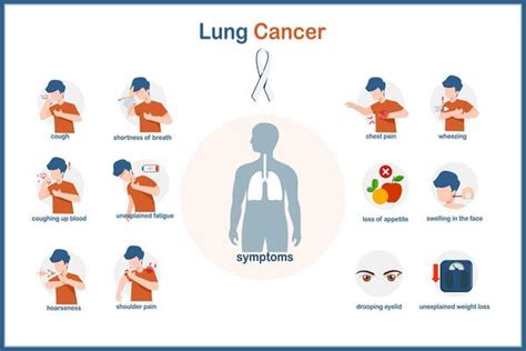 Lung Cancer Symptoms Vector Art, Icons, and Graphics for Free Download