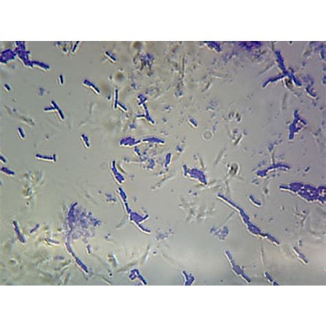 Bacillus Subtilis Microscope