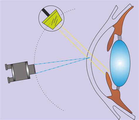 Print Slit Lamp Illuminations Flashcards Easy Notecards