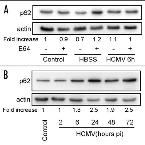 The Inhibition Of Autophagy By HCMV Is A Direct Mechanism MRC5 Cells