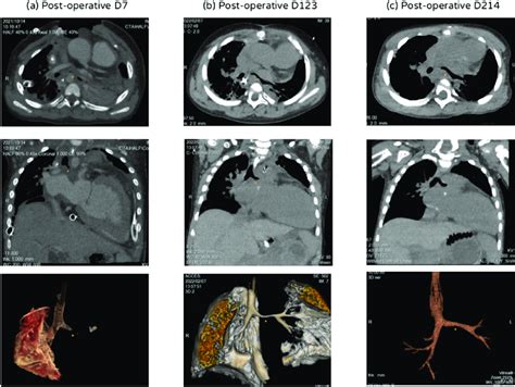 Computed Tomography Ct With Image Reconstruction A Left Panel Ct Download Scientific