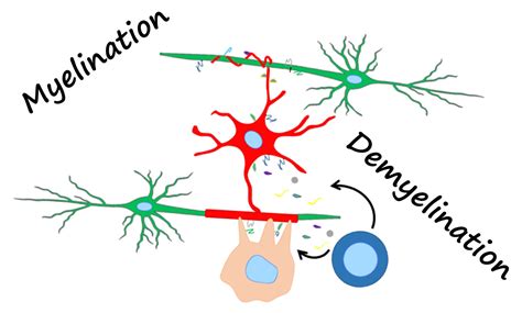 myelination-demyelination – Kerman Lab