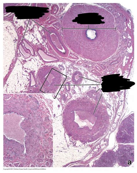 16 Male Reproductive System Histology Of Spermatic Cord And Ductus