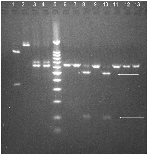 Sample Deletions Treated With Ssp I Restriction Enzymes Recognition Download Scientific