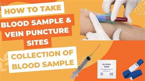 How To Take Blood Sample From Vein Blood Sample Collection Sites Of