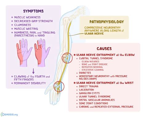 Pin On Ulnar Nerve