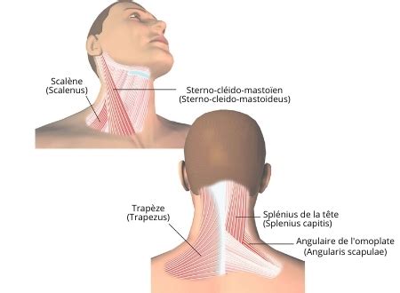 Torticolis définition symptômes diagnostic et traitement