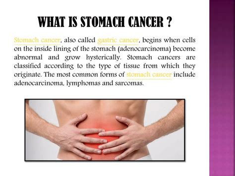 PPT - Stomach (Gastric) Cancer: Causes, symptoms, diagnosis, and ...