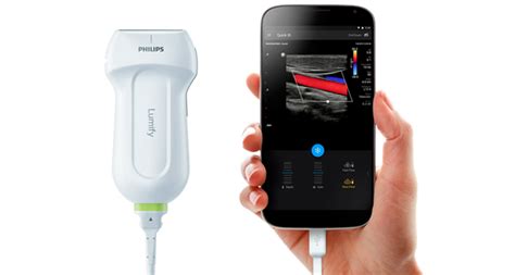 Philips Ultrasound Machines