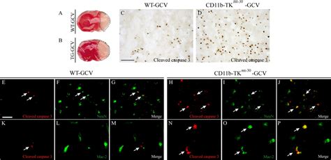 Selective Ablation Of Proliferating Microglial Cells Exacerbates